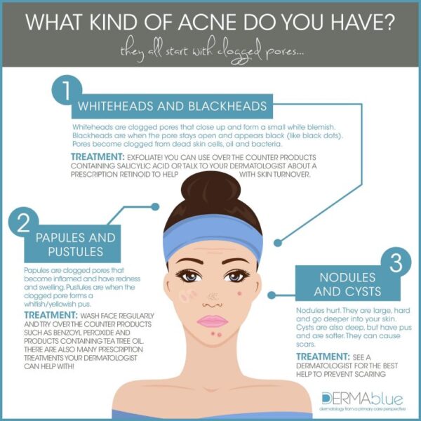 Different Types of Acne | Dermatology in Asheville NC