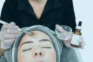 what is a chemical peel