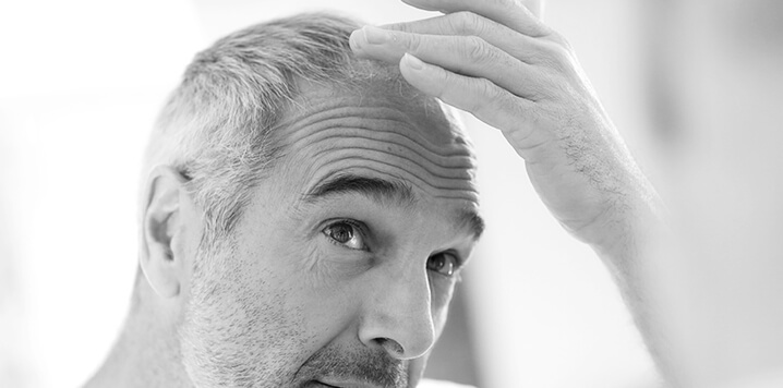 a man looking at his hair loss in a mirror