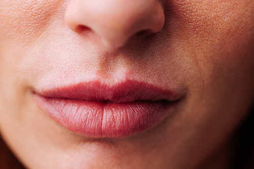 a woman with great lip filler results due to following lip filler aftercare tips