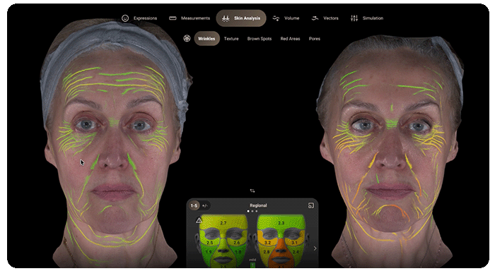 aura-advanced skin consultation - dermablue asheville nc