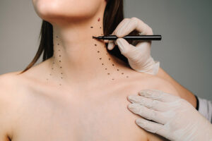How We Use Botox® & Dysport® for Neck Lifting, the Lower Face, and More