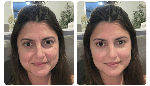 agelss-before-after
