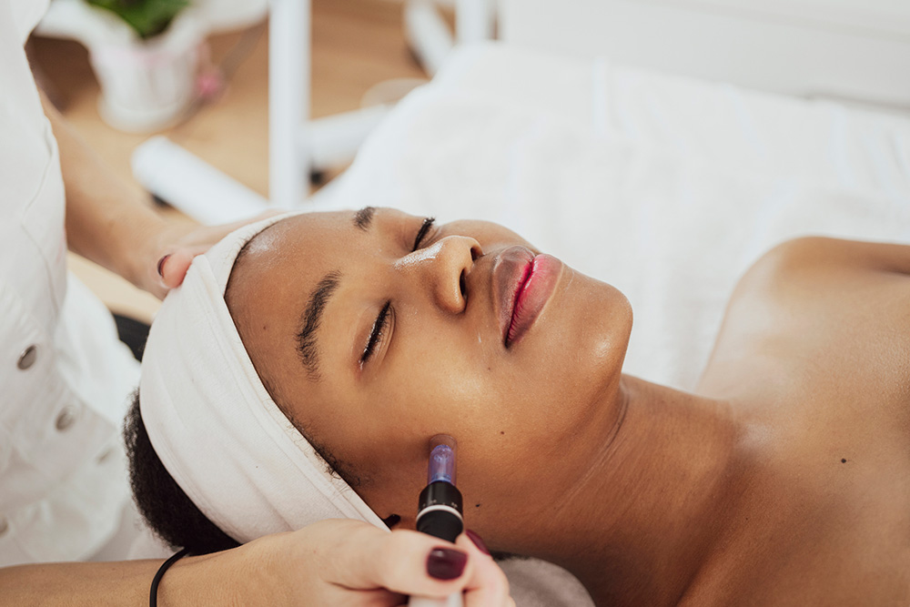 Microneedling vs. Laser Resurfacing for Acne Scars (Asheville & Hendersonville)